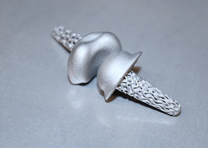 De FingerKIt implantaten worden geproduceerd met behulp van 3D-printprocessen die een hoge mate van detail en verschillende oppervlaktekwaliteiten mogelijk maken. (Foto: Fraunhofer IAPT)